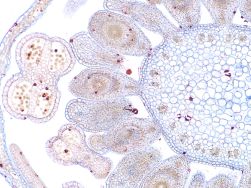 Prepared Slides, Monocot & DIcot comparison, t.s. flower buds