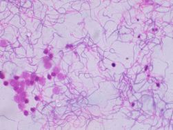Prepared Slides, Spermatozoa, frog