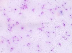 Prepared Slides, Spermatozoa, mammalian
