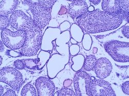 Prepared Slides, Testis, mammalian, for spermatogenesis