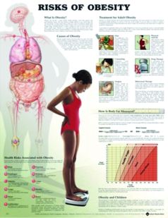 Chart,  Obesity, (Bachin) 50 x 66cm.