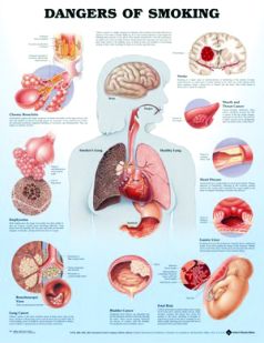Chart,  Dangers of Smoking, (Bachin) 50 x 66cm
