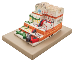 Models, Human Stomach Gradation