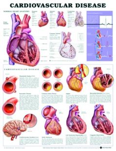 Chart,  Cardiovascular Diseases, (Bachin) 50 x 66cm