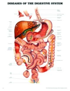 Chart,  Digestive System Diseases (Bachin) 50 x 66cm