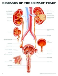 Chart,  Urinary Tract Disorders, (Bachin) 50 x 66cm