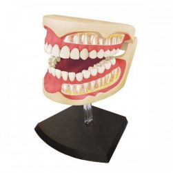 4D Human Adult Dentures Anatomy Model