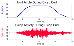 EKG Sensor