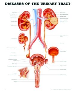 Chart,  Urinary Tract Disorders, (Bachin) 50 x 66cm